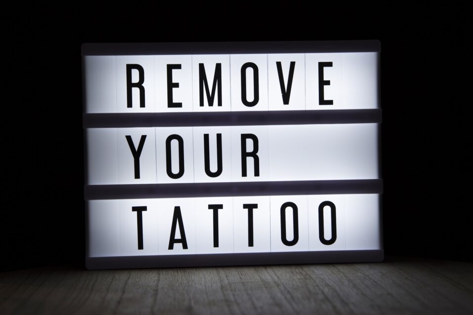 Text: Remove your tattoo